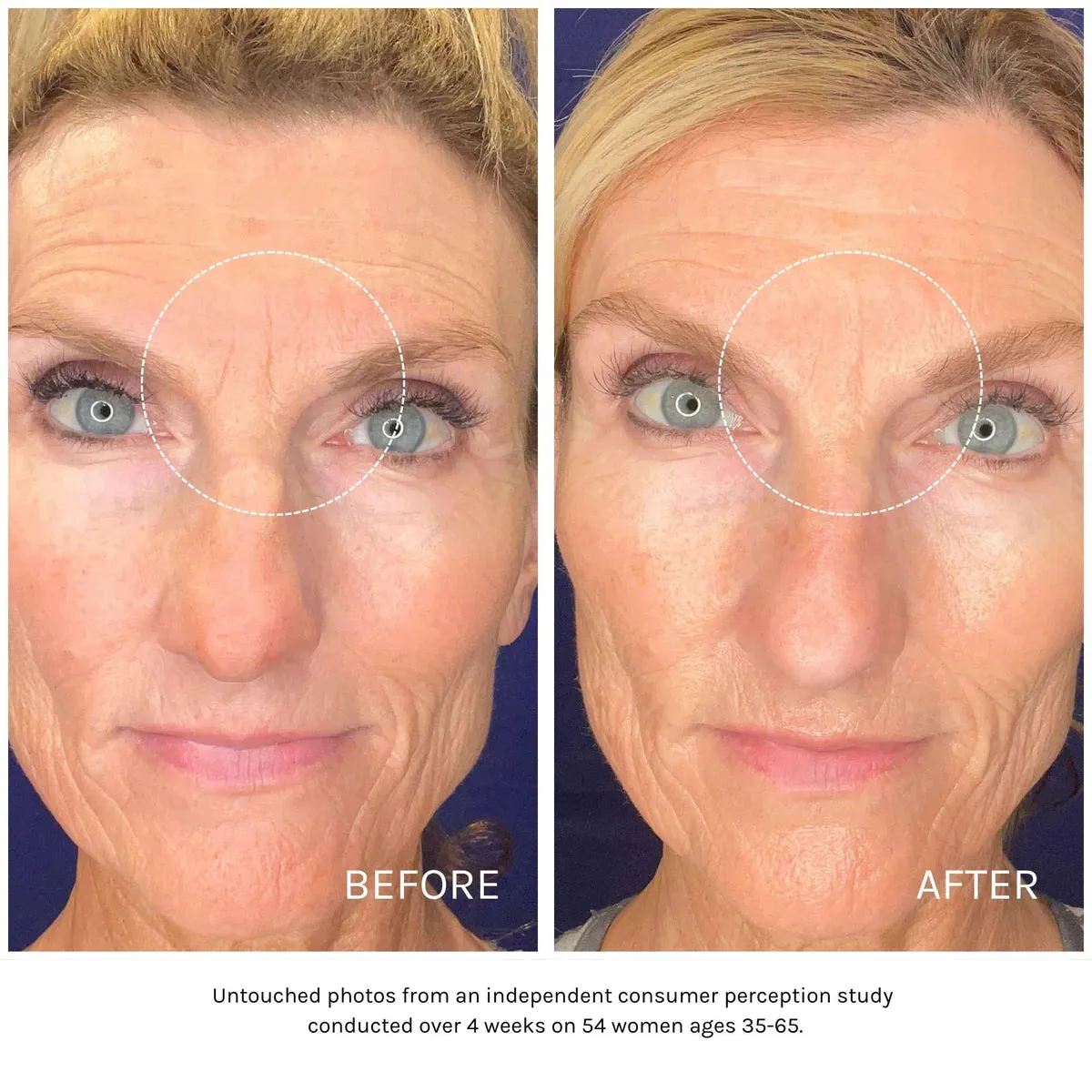 Essential Peptide Serum